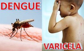 Alertan por repunte de dengue y varicela 